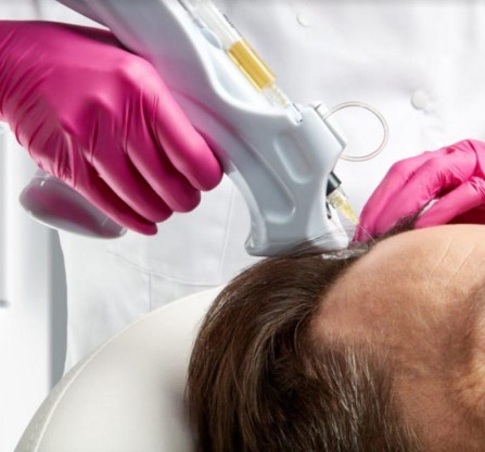 <p>Individuals with hereditary-type hair loss respond best to Platelet Rich Plasma. Your doctor is best-suited to help you choose this treatment based on your type of hair thinning or loss.</p>
<p>If you are a heavy smoker, take blood thinners, or have a medical condition such as cancer, liver disease, diabetes, chronic infections, or low platelet count, Platelet Rich Plasma may not be right for you.</p>
