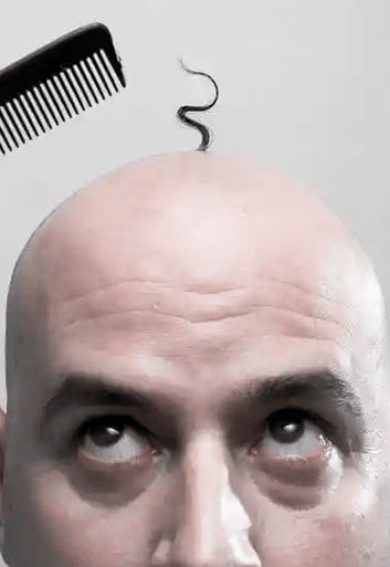 How can I avoid getting bald in Australia?