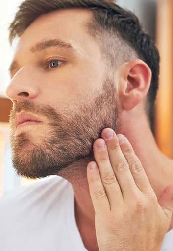 Does a beard transplant really work?