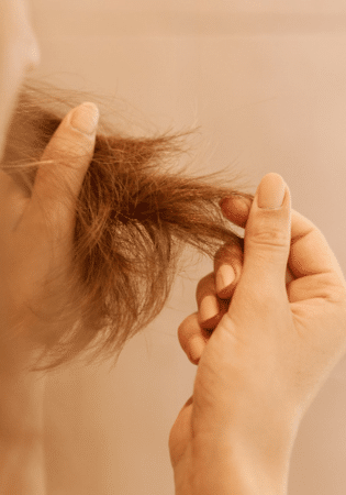 Spring Hair Loss: Understanding the Hair Loss Cycle