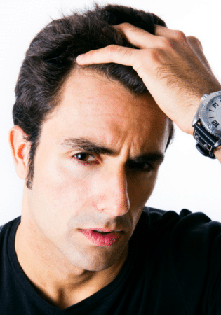 5 Clever Tricks to Hide a Receding Hairline