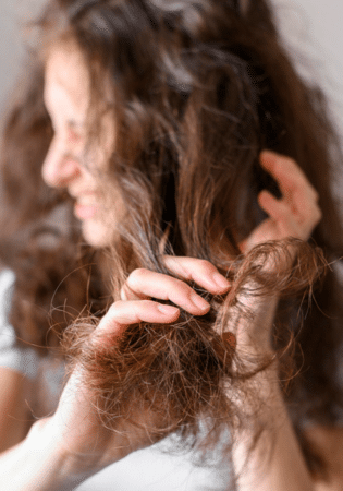 Understanding the Psychological Impact of Hair Loss
