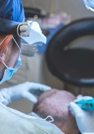 Hair Replacement Perth: What to Expect During Your Hair Transplant Journey
