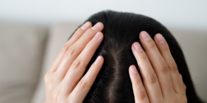 Hair Transplant