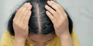 Hair Transplant