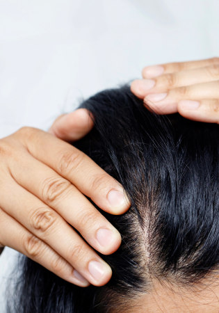 Cost of Hair Transplant Perth vs. Results: Is It Worth It?