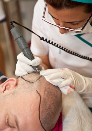 What Does Hair Transplant Cost? Top Clinic Pricing Your Complete Guide