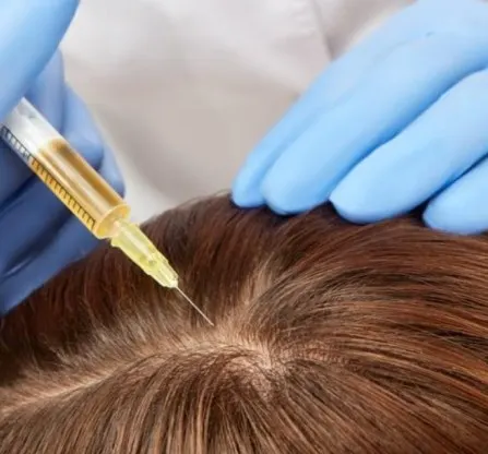 Hair Transplant & Hair Loss Treatment Clinic in Perth